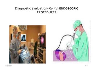 Diagnostic evaluation- Cont’d- ENDOSCOPIC
PROCEDURES
6/6/2024 117
 