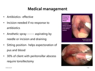 Medical management
• Antibiotics- effective
• Incision needed if no response to
antibiotics
• Ansthetic spray ------ aspirating by
needle or incision and draining
• Sitting position- helps expectoration of
pus and blood
• 30% of client with peritonsillar abscess
require tonsillectomy
6/6/2024 146
 