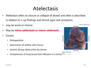 Atelectasis
• Atelectasis refers to closure or collapse of alveoli and often is described
in relation to x-ray findings and clinical signs and symptoms.
• may be acute or chronic
• May be micro atelectasis or macro atelectasis
• Causes
• Postoperative
• obstruction of airflow with mucus
• chronic airway obstruction by cancer
• Compression of lung tissue from effusion or a tumor
6/6/2024 164
 