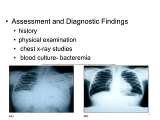 • Assessment and Diagnostic Findings
• history
• physical examination
• chest x-ray studies
• blood culture- bacteremia
6/6/2024 201
 