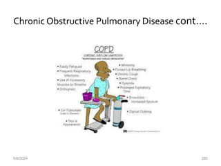 Chronic Obstructive Pulmonary Disease cont….
6/6/2024 280
 