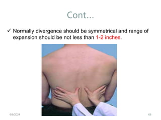 Cont…
68
 Normally divergence should be symmetrical and range of
expansion should be not less than 1-2 inches.
6/6/2024
 