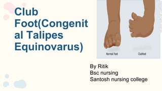 Club
Foot(Congenit
al Talipes
Equinovarus)
By Ritik
Bsc nursing
Santosh nursing college
 