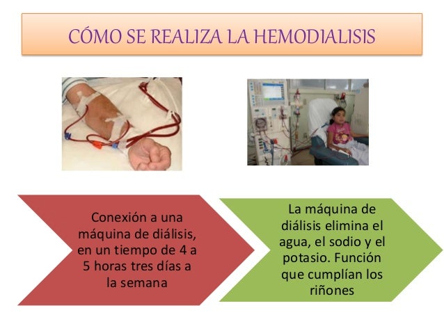 Si puede ser la psoriasis al niño en 5 meses