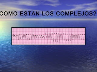 COMO ESTAN LOS COMPLEJOS?
 