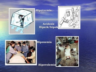 Hipotermia




    Acidosis
  Hiperk/hipok




Hipoxemia




 Hipovolemia
 