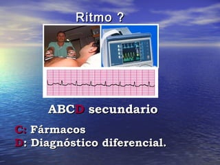 Ritmo ?




     ABCD secundario
C: Fármacos
D: Diagnóstico diferencial.
 