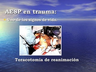 AESP en trauma:
• Uno de los signos de vida.




     Toracotomia de reanimación
 