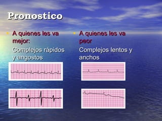 Pronostico
• A quienes les va    • A quienes les va
  mejor:                peor
  Complejos rápidos     Complejos lentos y
  y angostos            anchos
 