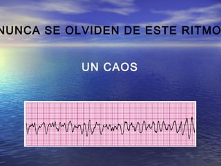 NUNCA SE OLVIDEN DE ESTE RITMO


           UN CAOS
 