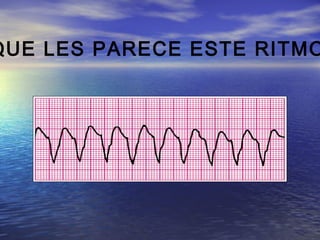 QUE LES PARECE ESTE RITMO
 