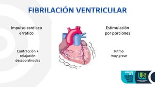 Impulso cardiaco
errático
Estimulación
por porciones
Contracción +
relajación
descoordinadas
Ritmo
muy grave
 