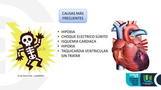 CAUSAS MÁS
FRECUENTES
• HIPOXIA
• CHOQUE ELECTRICO SÚBITO
• ISQUEMIA CARDIACA
• HIPOXIA
• TAQUICARDIA VENTRICULAR
SIN TRATAR
 