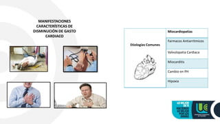 Etiologías Comunes
Miocardiopatías
Farmacos Antiarritmicos
Valvulopatia Cardiaca
Miocarditis
Cambio en PH
Hipoxia
MANIFESTACIONES
CARACTERÍSTICAS DE
DISMINUCIÓN DE GASTO
CARDIACO
 