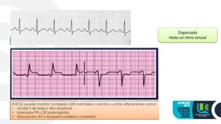 Organizado
Hasta un ritmo sinusal
 