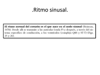 Ritmo sinusal- electrocardiografia i.ppt
