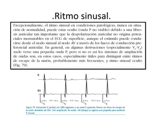 Ritmo sinusal- electrocardiografia i.ppt