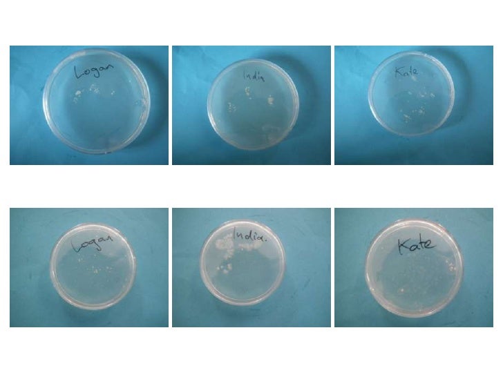 Agar plate results