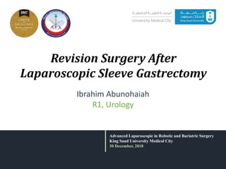 Revision Surgery After
Laparoscopic Sleeve Gastrectomy
Advanced Laparoscopic in Robotic and Bariatric Surgery
King Saud University Medical City
30 December, 2018
Ibrahim Abunohaiah
R1, Urology
 