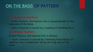 Fracture Pattern Math RIYA FRACTURE PPT.pptx