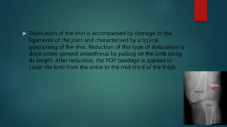 RIYA FRACTURE PPT.pptx