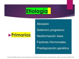 Etiología
Primarias
Gervis W (1949). Excision of the trapezium for osteoarthritis of the trapezio-metacarpal joint. J Bone Joint Surg; 31B 537-539
 