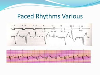 Paced Rhythms Various
 