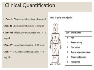  Zone 1- Above clavicle i.e face -4-6 mg/dl
Zone II-Chest, upper abdomen-6-8 mg/dl
Zone-III-Thighs, lower Ab,upper arm.-8-12
mg/dl
Zone-IV-Lower legs, forearm-12-14 mg/dl
Zone-V-feet, Hands (Palms & Soles)->15
mg /dl
Clinical Quantification
 