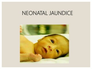 NEONATAL JAUNDICE
 
