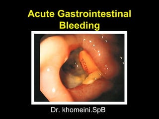 Acute Gastrointestinal
Bleeding
Dr. khomeini.SpB
 
