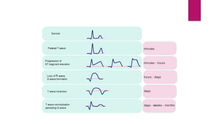 CONDUCTION AND
ABNORMALITIES
 