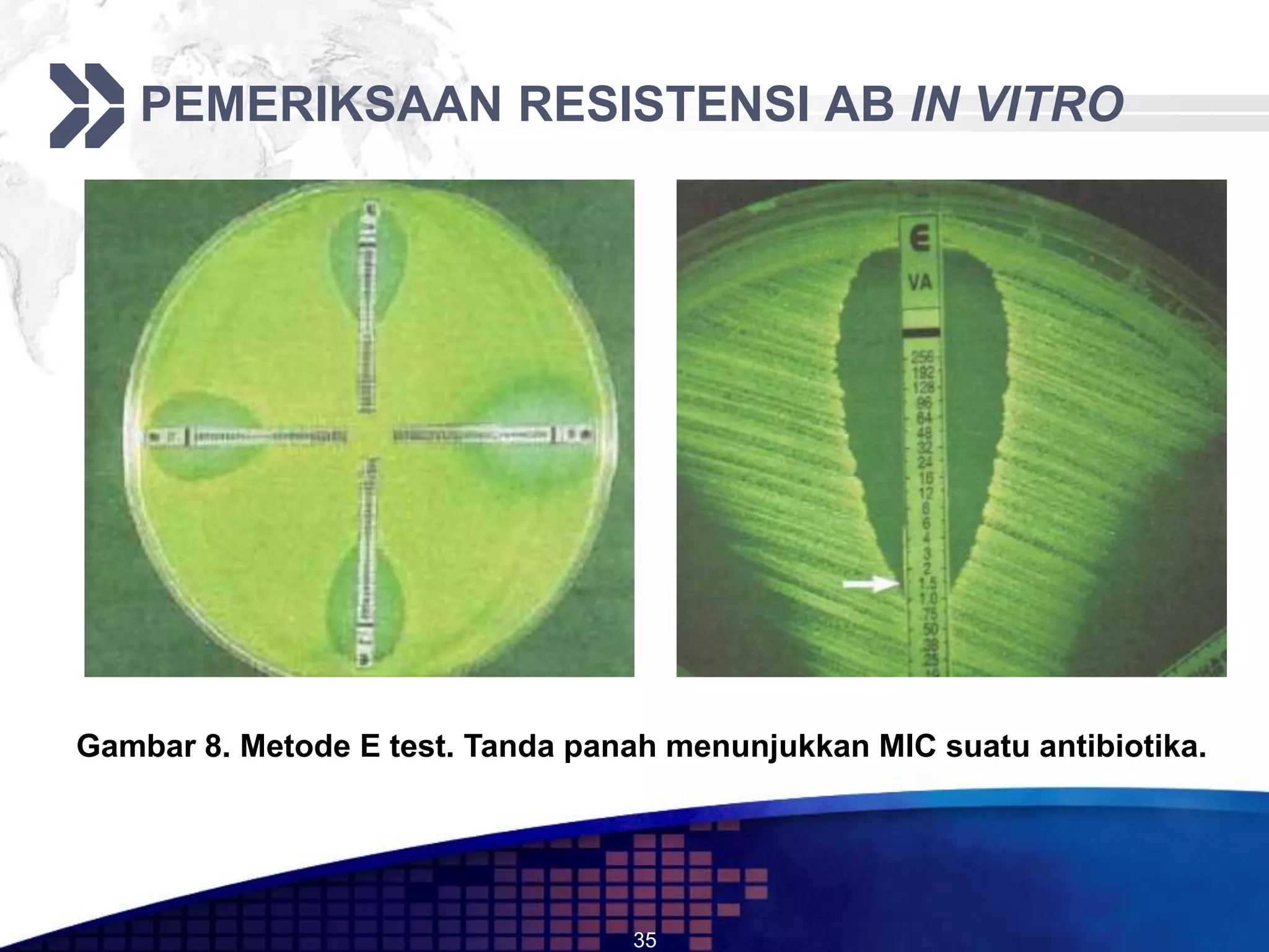 PEMERIKSAAN RESISTENSI AB IN VITRO




Gambar 8. Metode E test. Tanda panah menunjukkan MIC suatu antibiotika.




                                  35
 
