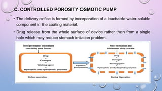 C. CONTROLLED POROSITY OSMOTIC PUMP
• The delivery orifice is formed by incorporation of a leachable water-soluble
component in the coating material.
• Drug release from the whole surface of device rather than from a single
hole which may reduce stomach irritation problem.
 