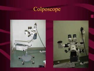 Colposcope
 