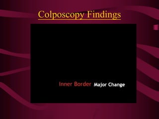Colposcopy Findings
 