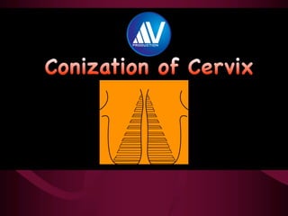 Cone Biopsy Procedure
 