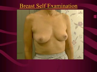 Breast Self Examination
 