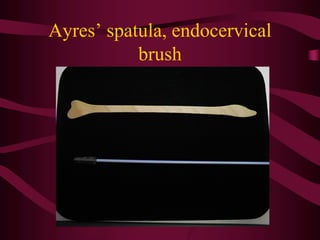 Ayres’ spatula, endocervical
brush
 