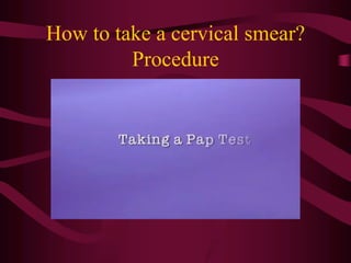 How to take a cervical smear?
Procedure
 