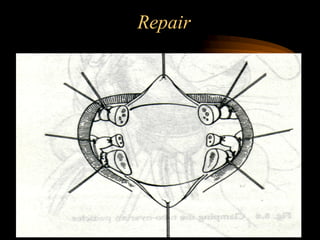 Repair
 