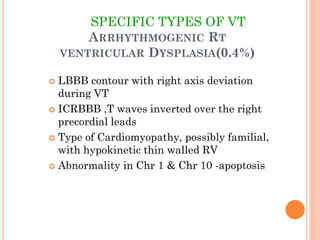 SPECIFIC TYPES OF VT
ARRHYTHMOGENIC RT
VENTRICULAR DYSPLASIA(0.4%)
 LBBB contour with right axis deviation
during VT
 ICRBBB ,T waves inverted over the right
precordial leads
 Type of Cardiomyopathy, possibly familial,
with hypokinetic thin walled RV
 Abnormality in Chr 1 & Chr 10 -apoptosis
 