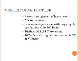 VENTRICULAR FLUTTER
 Severe derangement of heart beat
 Macro-reentrant
 Sine wave appearance, with large regular
oscillations (150-300 Bpm)
 Distinct QRS ,ST T are absent
 Difficult to distinguish between rapid VT
& V.flutter
 