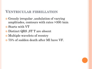 VENTRICULAR FIBRILLATION
 Grossly irregular ,undulation of varying
amplitudes, contours with rates >300 /min
 Starts with VT
 Distinct QRS ,ST T are absent
 Multiple wavelets of reentry
 75% of sudden death after MI have VF.
 