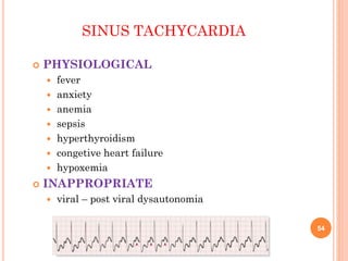 54
SINUS TACHYCARDIA
 PHYSIOLOGICAL
 fever
 anxiety
 anemia
 sepsis
 hyperthyroidism
 congetive heart failure
 hypoxemia
 INAPPROPRIATE
 viral – post viral dysautonomia
 