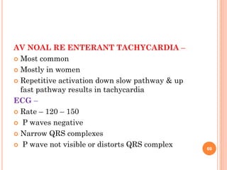 AV NOAL RE ENTERANT TACHYCARDIA –
 Most common
 Mostly in women
 Repetitive activation down slow pathway & up
fast pathway results in tachycardia
ECG –
 Rate – 120 – 150
 P waves negative
 Narrow QRS complexes
 P wave not visible or distorts QRS complex 69
 
