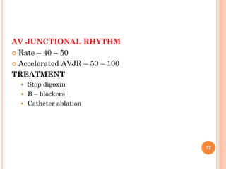 AV JUNCTIONAL RHYTHM
 Rate – 40 – 50
 Accelerated AVJR – 50 – 100
TREATMENT
 Stop digoxin
 B – blockers
 Catheter ablation
72
 