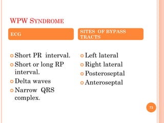 WPW SYNDROME
ECG
 Short PR interval.
 Short or long RP
interval.
 Delta waves
 Narrow QRS
complex.
SITES OF BYPASS
TRACTS
 Left lateral
 Right lateral
 Posteroseptal
 Anteroseptal
73
 