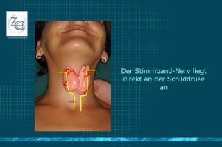 Der Stimmband-Nerv liegt direkt an der Schilddrüse an 