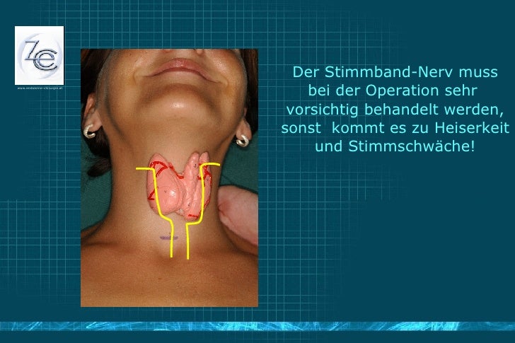 Was macht die Schilddrüse eigentlich