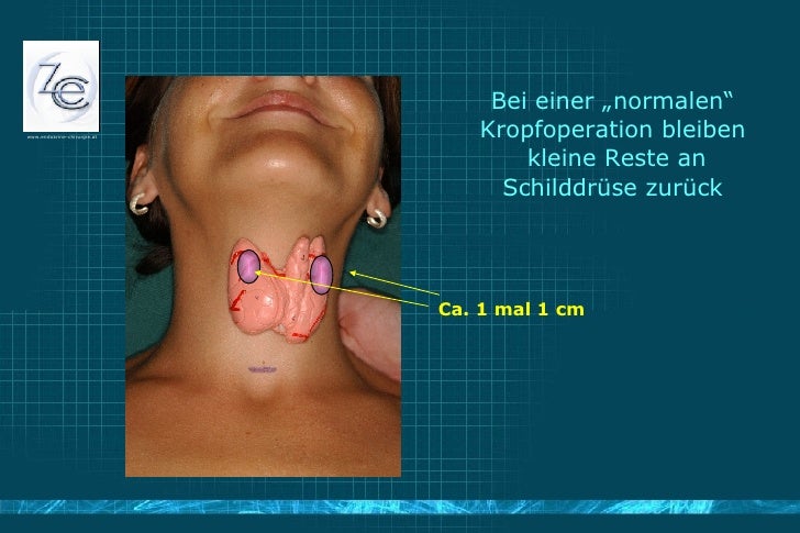 Was Macht Die Schilddruse Eigentlich